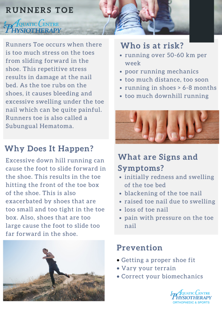 Aquatic Centre Physiotherapy | Runner's Toe: Causes, Risks, And Prevention